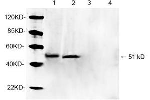 Image no. 1 for anti-Parkinson Protein 2, E3 Ubiquitin Protein Ligase (Parkin) (PARK2) (AA 300-350) antibody (ABIN1574065)