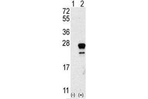 Image no. 3 for anti-GTPase NRas (NRAS) (AA 72-101) antibody (ABIN3031130)