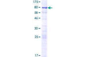 Image no. 1 for serum Response Factor Binding Protein 1 (SRFBP1) (AA 1-429) protein (GST tag) (ABIN1321313)