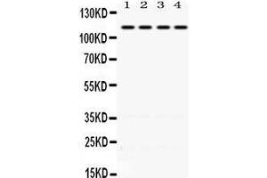 anti-Nuclear Receptor Subfamily 3, Group C, Member 2 (NR3C2) (AA 950-984), (C-Term) antibody