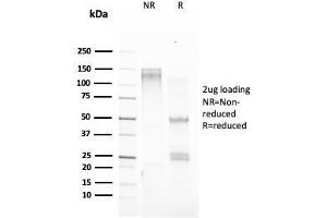 Image no. 1 for anti-Trefoil Factor 1 (TFF1) antibody (ABIN6940690)