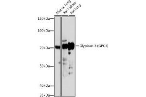 Western blot analysis of extracts of various cell lines, using Glypican 3 (GPC3) (GPC3) antibody (ABIN6127987, ABIN6141306, ABIN6141310 and ABIN6219094) at 1:1000 dilution.