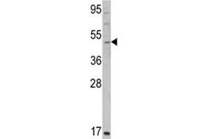 Image no. 3 for anti-GATA Binding Protein 2 (GATA2) (AA 380-407) antibody (ABIN3031028)