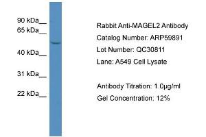 Image no. 2 for anti-MAGE-Like 2 (MAGEL2) (N-Term) antibody (ABIN2788252)