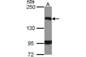 Image no. 3 for anti-BRCA1 Interacting Protein C-terminal Helicase 1 (BRIP1) (N-Term) antibody (ABIN2857051)