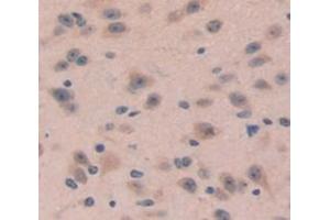 Image no. 2 for anti-Dickkopf Homolog 4 (Xenopus Laevis) (DKK4) (AA 37-141) antibody (ABIN1858646)