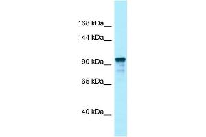 Image no. 1 for anti-Unc-13 Homolog D (UNC13D) (C-Term) antibody (ABIN2789769)