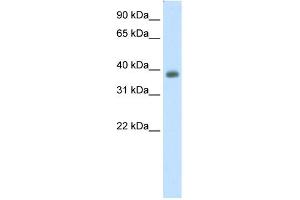 Image no. 1 for anti-Neurogenic Differentiation 2 (NEUROD2) (C-Term) antibody (ABIN2780746)