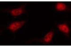 Image no. 1 for anti-Vitamin D Receptor (VDR) (pSer208) antibody (ABIN6255086)