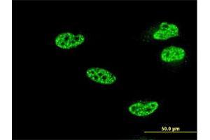 Immunofluorescence of monoclonal antibody to NFKB1 on HeLa cell.