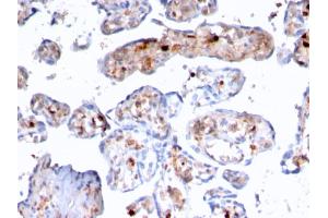 Immunohistochemistry (IHC) image for anti-S100 Calcium Binding Protein A4 (S100A4) (AA 1-200) antibody (ABIN6940544)