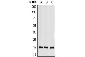 Image no. 1 for anti-Interleukin 28A (Interferon, lambda 2) (IL28A) (Center) antibody (ABIN2706385)
