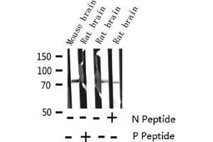 Image no. 3 for anti-Synapsin I (SYN1) (pSer9) antibody (ABIN6255558)