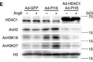 Image no. 19 for anti-Histone Deacetylase 1 (HDAC1) (Center) antibody (ABIN2854776)