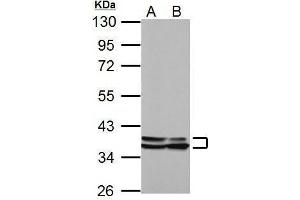 WB Image Sample (30 ug of whole cell lysate) A: NIH-3T3 B: JC 10% SDS PAGE antibody diluted at 1:10000