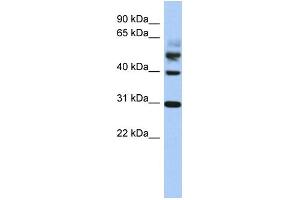 Image no. 1 for anti-Tubulin tyrosine Ligase (TTL) (Middle Region) antibody (ABIN2785284)