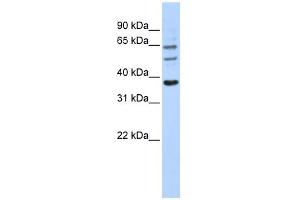 Image no. 1 for anti-UDP Glucuronosyltransferase 1 Family, Polypeptide A9 (UGT1A9) (N-Term) antibody (ABIN2775485)