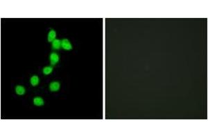 Image no. 2 for anti-Dual-Specificity tyrosine-(Y)-phosphorylation Regulated Kinase 1A (DYRK1A) (AA 21-70) antibody (ABIN1533878)