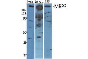 Image no. 2 for anti-ATP-Binding Cassette, Sub-Family C (CFTR/MRP), Member 3 (ABCC3) (Internal Region) antibody (ABIN3185638)