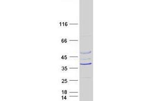 Image no. 1 for Rhabdoid Tumor Deletion Region Gene 1 (RTDR1) protein (Myc-DYKDDDDK Tag) (ABIN2731235)