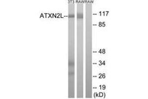 Image no. 1 for anti-Ataxin 2-Like (ATXN2L) (AA 571-620) antibody (ABIN1534658)