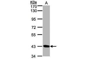 Image no. 2 for anti-serine/threonine Kinase 17a (STK17A) (Center) antibody (ABIN2856520)