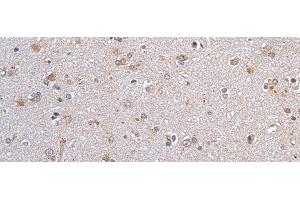 Immunohistochemistry of paraffin-embedded Human brain tissue using CLDN12 Polyclonal Antibody at dilution of 1:45(x200)