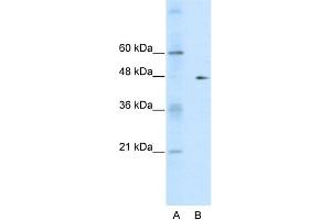 Image no. 2 for anti-GDP Dissociation Inhibitor 2 (GDI2) (C-Term) antibody (ABIN2792268)