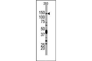 Image no. 1 for anti-Phosphoinositide-3-Kinase, Catalytic, delta Polypeptide (PIK3CD) (N-Term) antibody (ABIN360449)