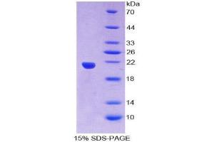 Image no. 1 for Small Nuclear Ribonucleoprotein Polypeptide C (SNRPC) (AA 2-159) protein (His tag,T7 tag) (ABIN2126798)
