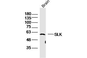 Image no. 2 for anti-STE20-Like Kinase (SLK) (AA 165-270) antibody (ABIN2179263)