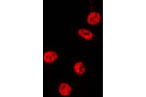 Image no. 1 for anti-RNA Terminal Phosphate Cyclase-Like 1 (RCL1) (C-Term) antibody (ABIN6259496)