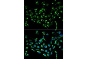 Immunofluorescence analysis of MCF7 cell using CDKN3 antibody.