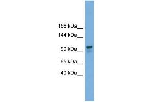 Image no. 1 for anti-Glucosidase, Alpha, Neutral AB (GANAB) (Middle Region) antibody (ABIN2786407)