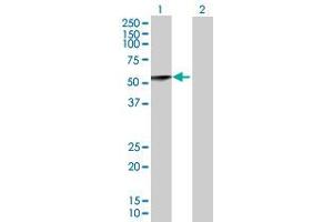 Image no. 1 for anti-Calsequestrin 2 (CASQ2) (AA 1-399) antibody (ABIN514028)