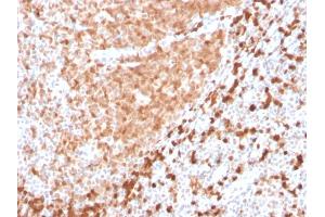 Image no. 3 for anti-T-Cell Leukemia/lymphoma 1A (TCL1A) (AA 2-109) antibody (ABIN6940950)
