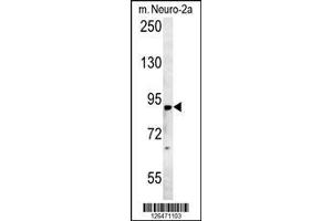 Image no. 2 for anti-Zinc Finger Protein 387 (ZNF387) (AA 339-367), (N-Term) antibody (ABIN651571)
