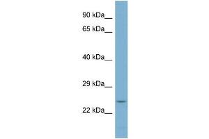 FVT1 antibody  (N-Term)