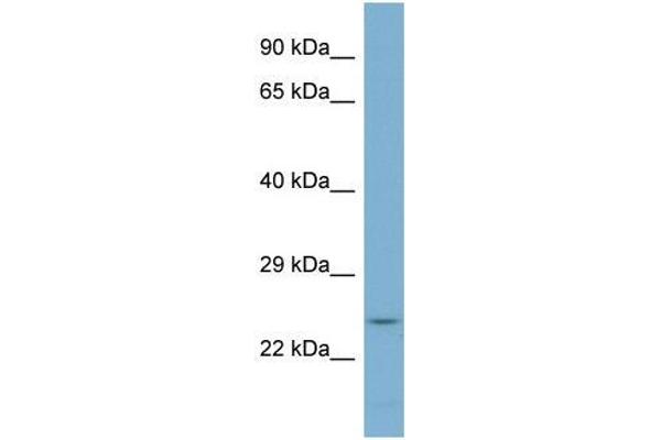 anti-3-Ketodihydrosphingosine Reductase (KDSR) (N-Term) antibody