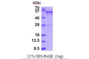 Image no. 1 for Bromodomain Containing 3 (BRD3) (AA 1-416) protein (His tag) (ABIN5854008)