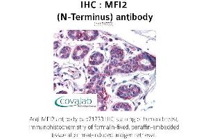 Image no. 1 for anti-Antigen P97 (Melanoma Associated) Identified By Monoclonal Antibodies 133.2 and 96.5 (MFI2) (N-Term) antibody (ABIN1736927)
