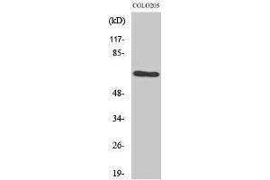 Image no. 1 for anti-G Protein-Coupled Receptor Kinase 1 (GRK1) (Thr8) antibody (ABIN3184939)
