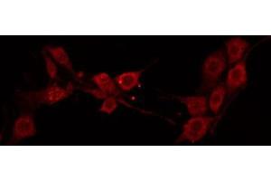 Image no. 2 for anti-Olfactomedin-Like 2B (OLFML2B) (Internal Region) antibody (ABIN6264184)