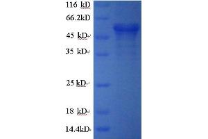 Image no. 1 for Calreticulin (CALR) (AA 18-416) protein (GST tag) (ABIN5709181)