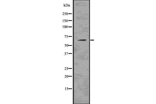 anti-Perilipin 1 (PLIN1) (C-Term) antibody