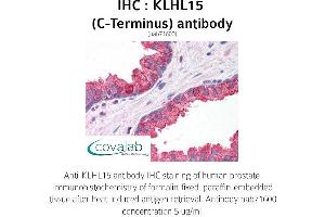 Image no. 1 for anti-Kelch-Like 15 (KLHL15) (C-Term) antibody (ABIN1736246)
