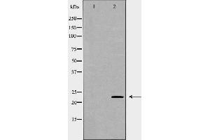 Image no. 1 for anti-Claudin 1 (CLDN1) antibody (ABIN6260877)