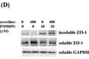 Image no. 52 for anti-Glyceraldehyde-3-Phosphate Dehydrogenase (GAPDH) (Center) antibody (ABIN2857072)