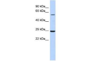 Image no. 1 for anti-Lysophosphatidylcholine Acyltransferase 1 (LPCAT1) (Middle Region) antibody (ABIN635206)
