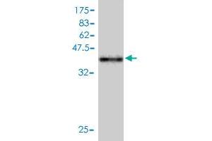Image no. 2 for anti-Tax1 (Human T-Cell Leukemia Virus Type I) Binding Protein 3 (TAX1BP3) (AA 1-124) antibody (ABIN565480)